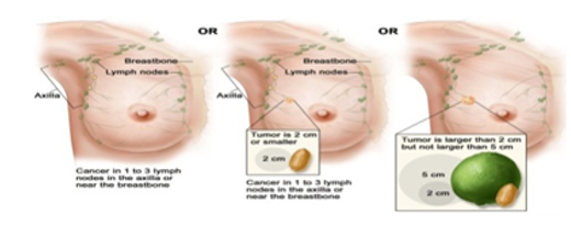 Shows the women with early stage positive beast cancer
